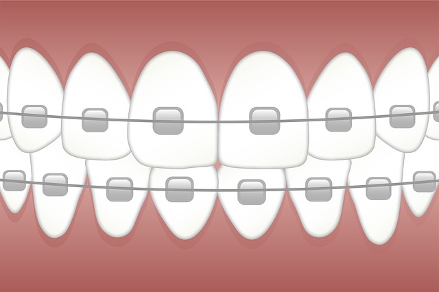 srovnané zuby pomocí aparátu